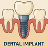 How Much Dental Implant cost price in dubai from Aed 2999