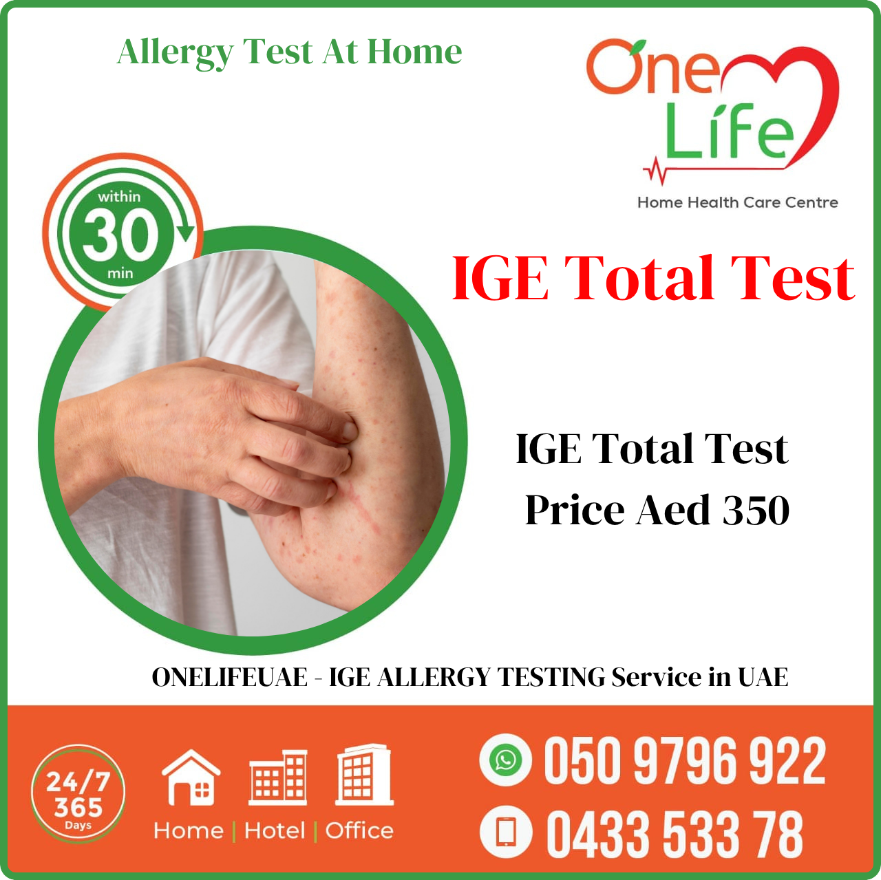 IgE Test - Immunoglobulin IgE Total Test