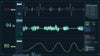 ECG Test In Dubai | EKG Test in Dubai