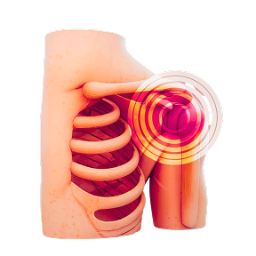 Frozen Shoulder Physio